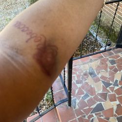MUSC Health - I NEVERRR been stuck In a tattoo or let alone that part of my arm