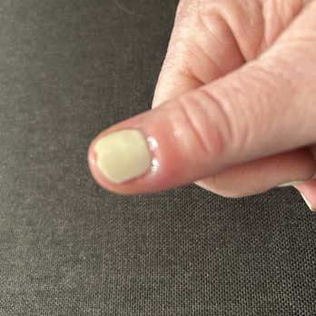 Studio 79 Nails and Spa - Infection that needed to be seen by a doctor I'm on antibiotics - Nail Salons Near Me - La Habra, California Studio 79 Nails and Spa - Infection that needed to be seen by a doctor I'm on antibiotics - Nail Salons Near Me - La Habra, California