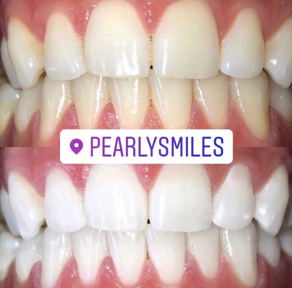 Salinas Pearly Smiles Logo