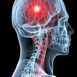 Southern California Brain Center - Board Certified Chiropractic Neurologist