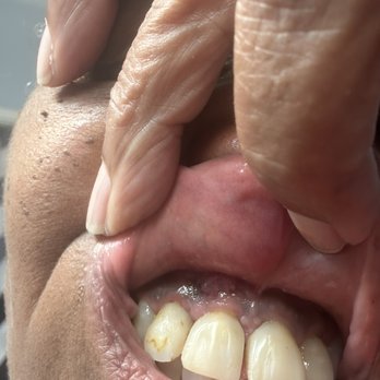 Clear Choice Riverside - Gum infection - Cosmetic Dentists Near Me - Riverside, California Clear Choice Riverside - Gum infection - Cosmetic Dentists Near Me - Riverside, California