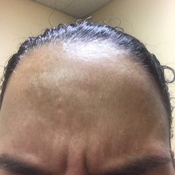 Schweiger Dermatology Group - Dermatologists Near Me - Marlton, New Jersey