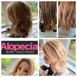 Alopecia Hair Solutions