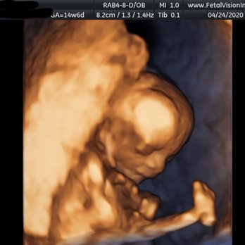 Fetal Vision Imaging - Diagnostic Imaging Near Me - Philadelphia, Pennsylvania Fetal Vision Imaging - Diagnostic Imaging Near Me - Philadelphia, Pennsylvania