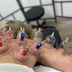 Back2Life Physical Therapy and Wellness - Cupping is one of many ways to loosen up the muscle tissue and fascia