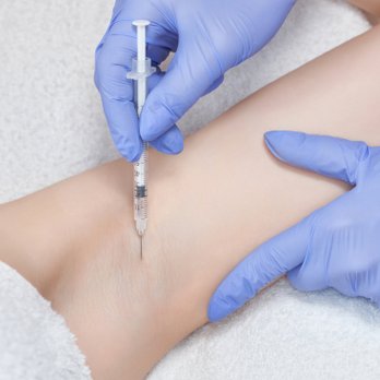 The Glam Doc - Botox for sweating! Lasts 1-1.5 years. - Medical Spas Near Me - Scottsdale, Arizona The Glam Doc - Botox for sweating! Lasts 1-1.5 years. - Medical Spas Near Me - Scottsdale, Arizona