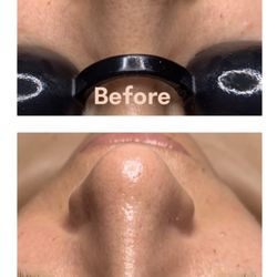 Orissa Spa Boutique - Before and After a Classic Facial