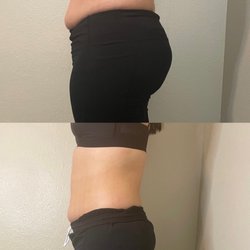 The Hourglass Method