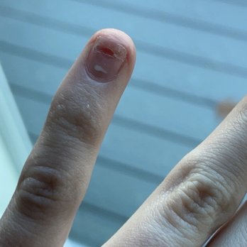 Jazzi's Nail - Damaged nail from drilling - Nail Salons Near Me - Milford, New Hampshire Jazzi's Nail - Damaged nail from drilling - Nail Salons Near Me - Milford, New Hampshire