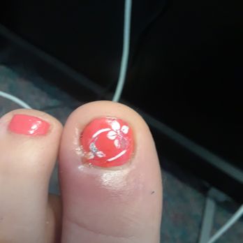 Regal Nails, Salon & Spa - Infection due to unsteralized tools - Nail Salons Near Me - Albuquerque, New Mexico Regal Nails, Salon & Spa - Infection due to unsteralized tools - Nail Salons Near Me - Albuquerque, New Mexico