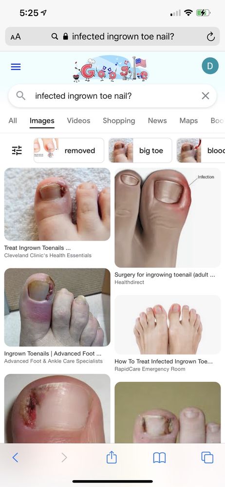 Nail Therapy Image