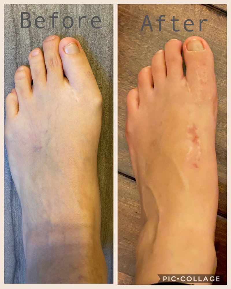 ISSAQUAH FOOT & ANKLE SPECIALISTS 27 Photos & 65 Reviews 450 NW