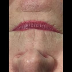 Client B - BEFORE