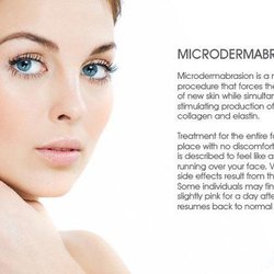 S.O. Radiant Skin - Microdermabrasion Treatments