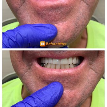 Direct Dental Lab - Cosmetic Dentists Near Me - Spring Valley, Nevada Direct Dental Lab - Cosmetic Dentists Near Me - Spring Valley, Nevada