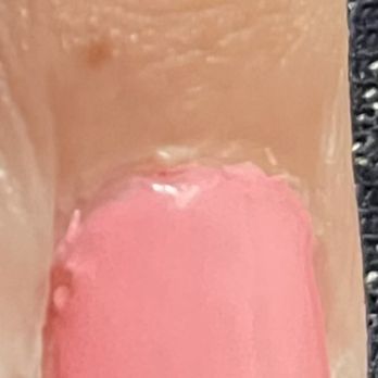 Savvy Nails - Bad nail job - Nail Salons Near Me - Woodland, California Savvy Nails - Bad nail job - Nail Salons Near Me - Woodland, California