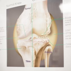 Lyceum Physical Medicine