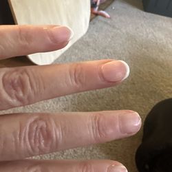 Unpainted/broken nails