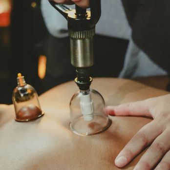 Sento House - We have cupping specialists - Massage Near Me - Hilo, Hawaii Sento House - We have cupping specialists - Massage Near Me - Hilo, Hawaii