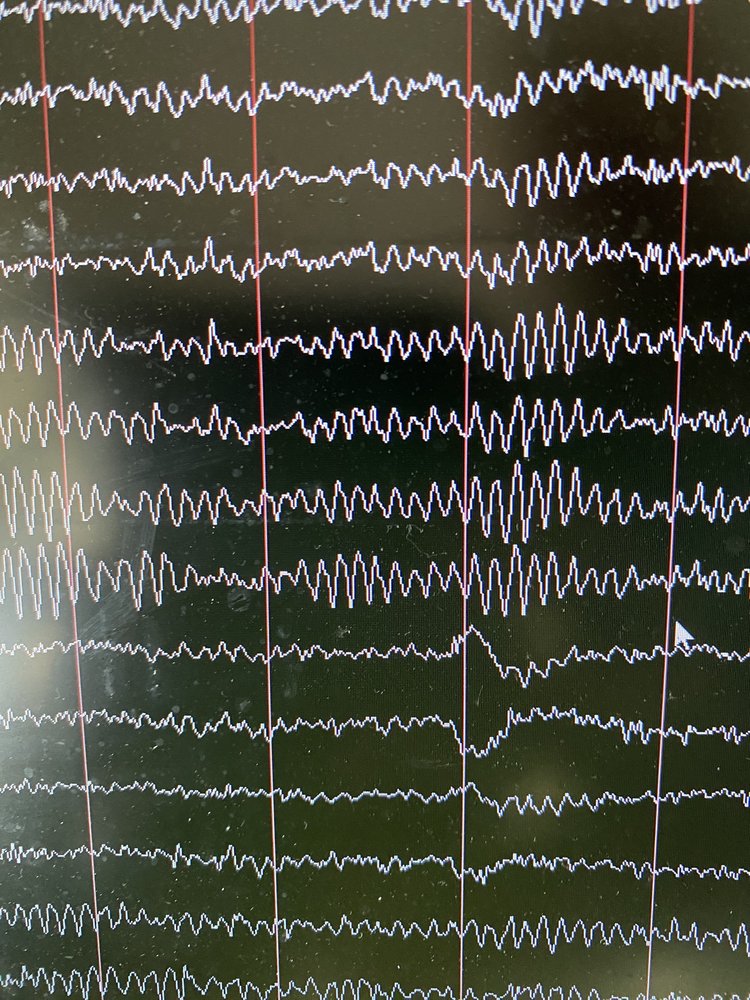 Neurofeedback - grief counselor in Tempe, AZ