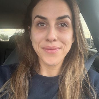 Facile Dermatology + Boutique - After Pic! - Skin Care Near Me - Pasadena, California Facile Dermatology + Boutique - After Pic! - Skin Care Near Me - Pasadena, California