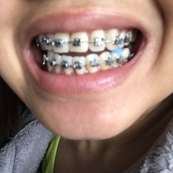 Povolny Orthodontics - Orthodontists Near Me - Tukwila, Washington Povolny Orthodontics - Orthodontists Near Me - Tukwila, Washington