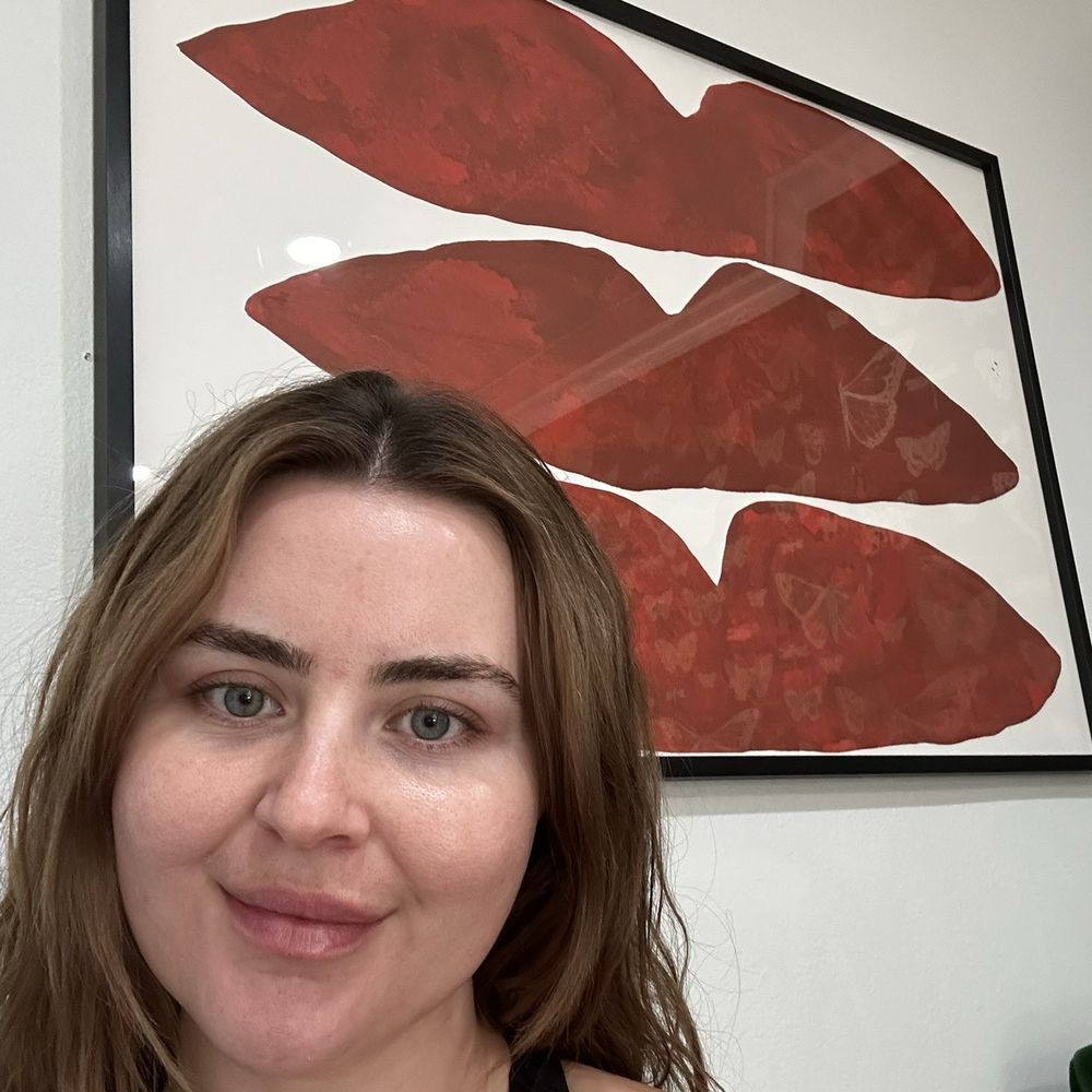 Morph Aesthetics - Taken in office right after injections - Aestheticians Near Me - Phoenix, Arizona
