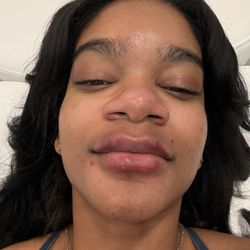 CurateMD Skin Bar and Wellness Clinic - Before first treatment