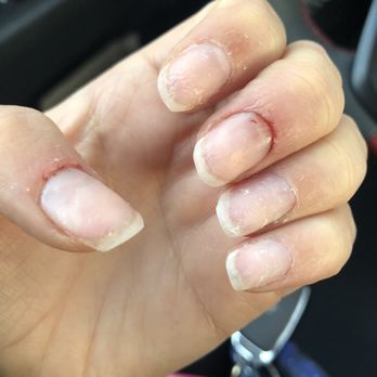 Precious Nails - After I cleaned up the blood that was gushed all over my fingers it still continued to bleed. - Nail Salons Near Me - Fairfield, New Jersey Precious Nails - After I cleaned up the blood that was gushed all over my fingers it still continued to bleed. - Nail Salons Near Me - Fairfield, New Jersey