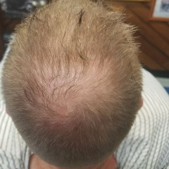 Vanishing American Barber Shop - Before hair treatment - Barbers Near Me - Gresham, Oregon