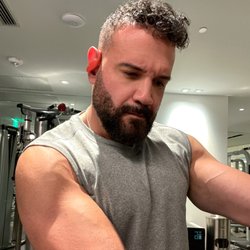 ForHair Hair Transplant Clinic - After at gym
