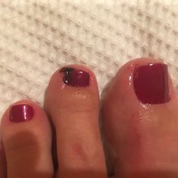 Gioe - My bleeding toe after a rough and sloppy pedicure
