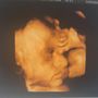 Bump2Baby 3D Ultrasound Studio