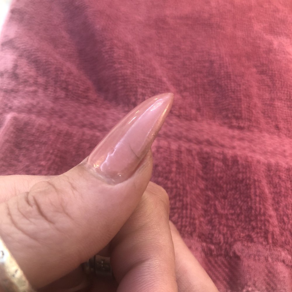 Venetian Nail Spa - Severely cracked nail. See other clients post about. - Nail Salons Near Me - Plano, Texas