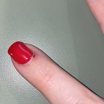 Hollywood Nails Salon - Cut on my cuticle - Nail Salons Near Me - Aurora, Illinois