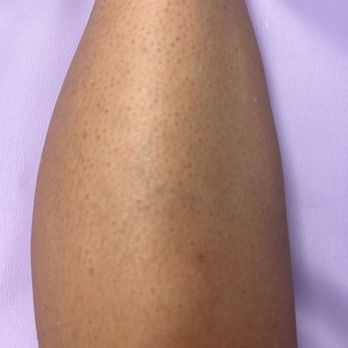 Cinnskin Wax Studio - Leg wax - Waxing Near Me - Concord, California