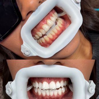 Luxe White Smiles - Teeth Whitening Near Me - Glendale, Arizona