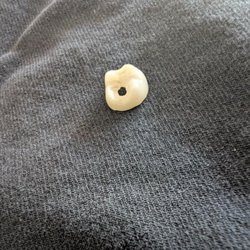 Summerlin Smiles - This happened TWICE!