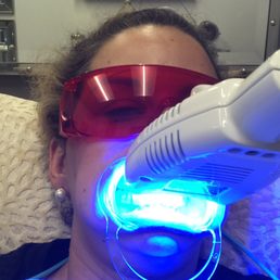 During whitening During whitening