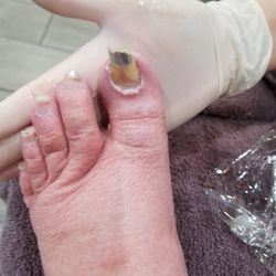 Holy Nails - Before picture of my over grown too long thick toe nails.