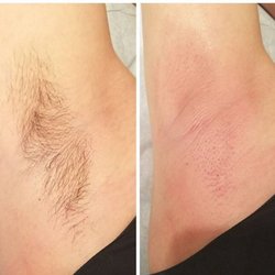 Bare Beauté Studio - Underarms