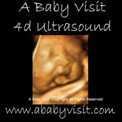 A Baby Visit 3D 4D Ultrasound - My little yawn (www.ababyvisit.com)