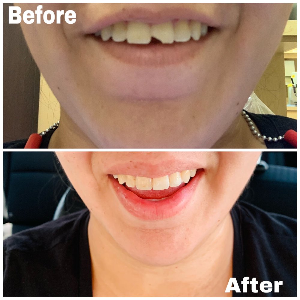 RIALTO DENTAL CARE Updated August 2024 11 Photos & 33 Reviews 579