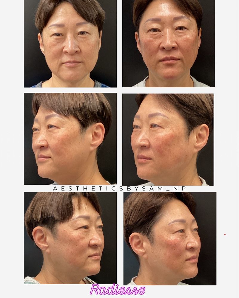 Npsl Aesthetics, Inc. Logo