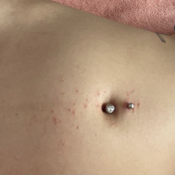 My Tattoo - allergic reaction - Tattoo Near Me - Alhambra, California