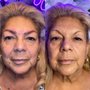 Photo of Brows By Glo