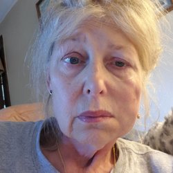 Derek G Cody, MD - My face now.