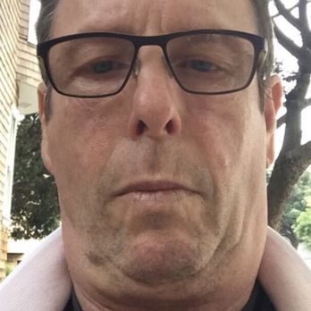 James P. Anthony, MD, FACS - Before - Plastic Surgeons Near Me - San Francisco, California James P. Anthony, MD, FACS - Before - Plastic Surgeons Near Me - San Francisco, California