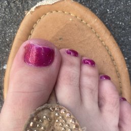 The blood on my toe. The blood on my toe.