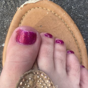 Best Nails - The blood on my toe. - Nail Salons Near Me - Wilkesboro, North Carolina Best Nails - The blood on my toe. - Nail Salons Near Me - Wilkesboro, North Carolina
